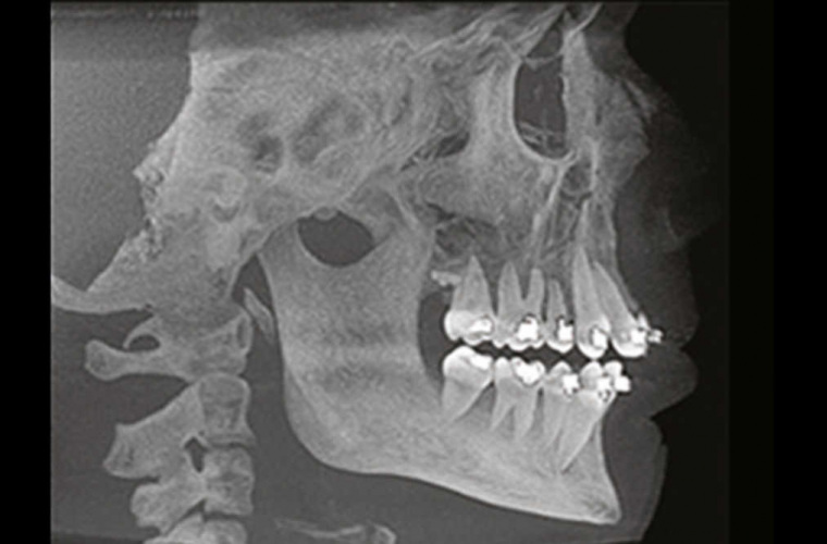 Použití technologie Cone Beam v ortodoncii